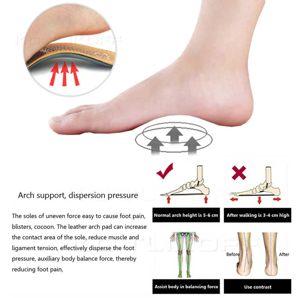 KOTLIKOFF High Quality Leather Orthotics Insole For Flat Foot Arch Support 25mm Orthopedic Silicone Insoles For Men And Women