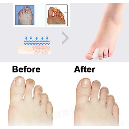 8Pcs Women Silicone Gel Tube Finger Toe Protectors Blister Protect Foot Feet Pain Relief Feet Care Feet Care Product C477