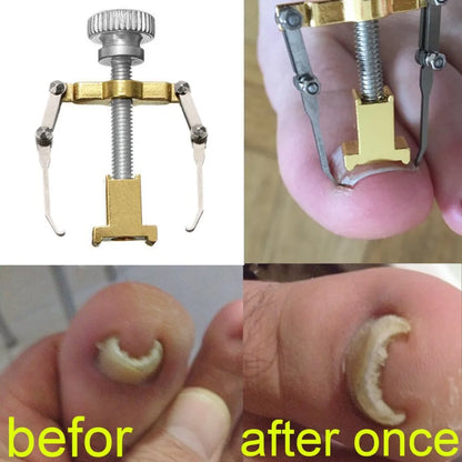 Ingrown Toenails correction pedicure foot  toe nail care tools file Elastic Patch Straightening Clip Brace corrector Wire Fixer