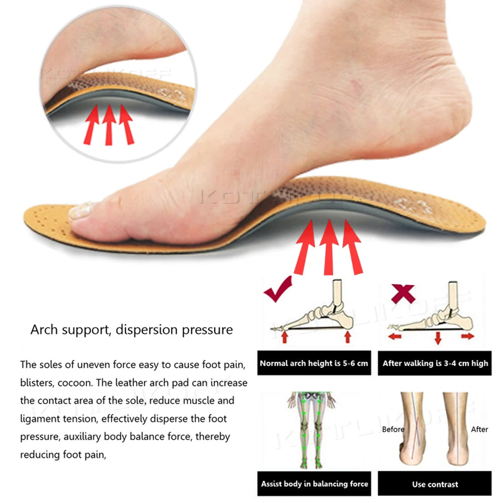 KOTLIKOFF High Quality Leather Orthotics Insole For Flat Foot Arch Support 25mm Orthopedic Silicone Insoles For Men And Women