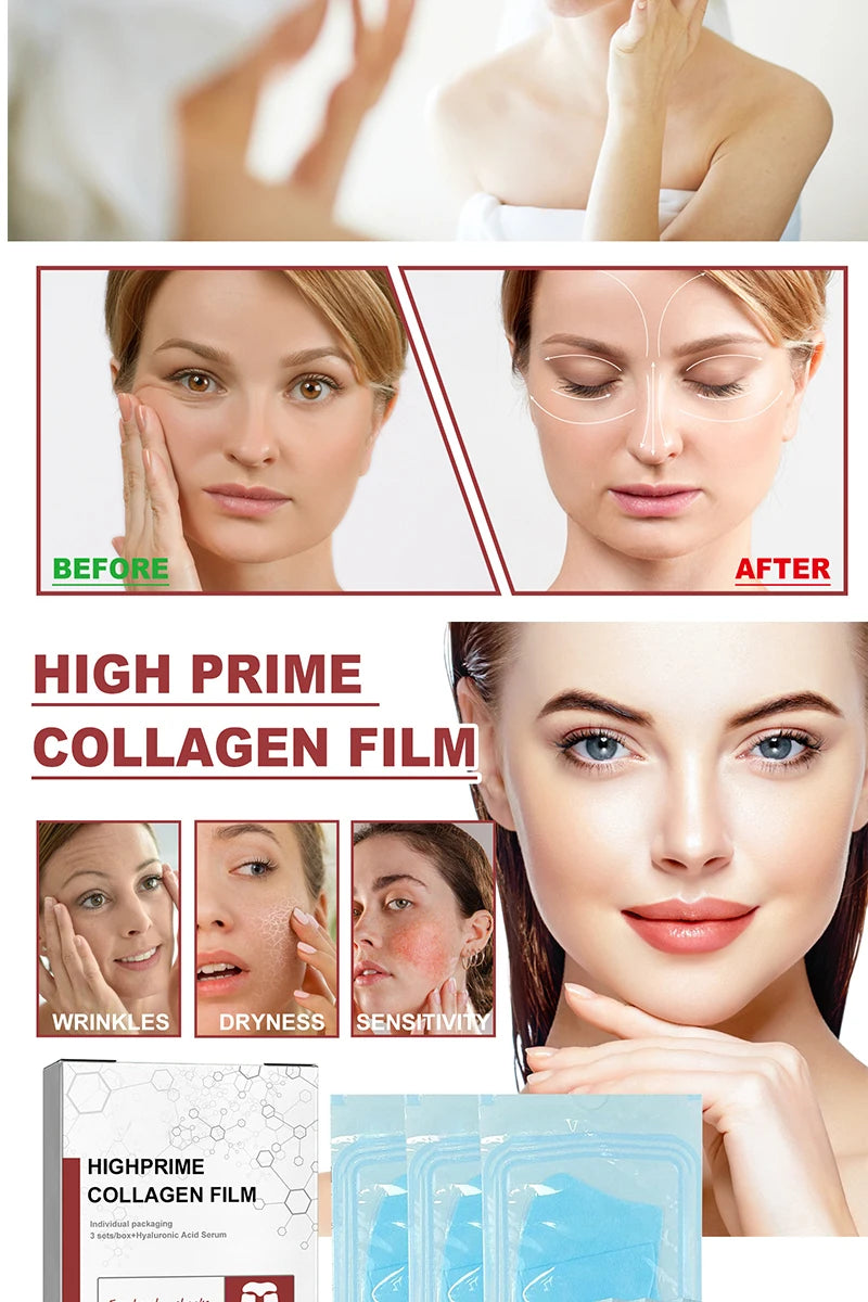Collagen Membrane Lightens Wrinkles, Bags, Dark Circles, Firming Skin, Plump And Moisturizing Eye Rejuvenation Membrane