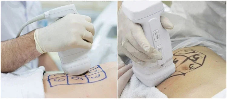 Body  Cellulite Massager Liposonix  Weight Loss Body Shaping Equipment 2023
