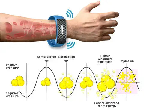 UltraSonic Lymph Drainage Slim Fit Wristband Weight Loss Bracelet Weight Loss Bracelet Magnetic Therapy Burning Fat Health Watch