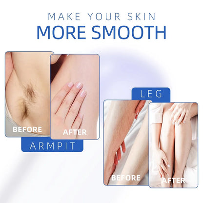 Honey Epilatory Waxing Kit Depilatory Roll on Wax Heater Machine with Refillable Wax Cream&100PCS Waxing Papers For Hair Removal